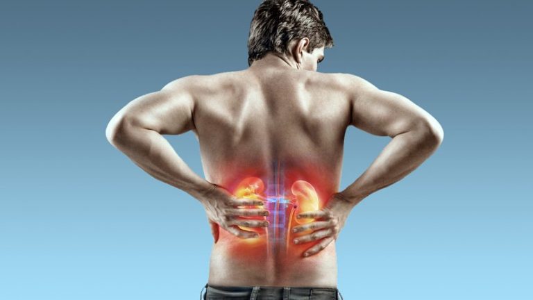 Veja como funciona a cirurgia de cálculo renal